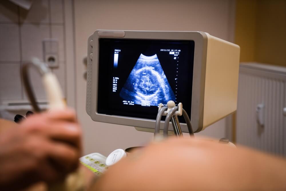 Application of Ultrasound Imaging in Modern Medicine explained by PostDICOM